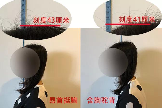 你可能也變得脖子前傾、含胸駝背了