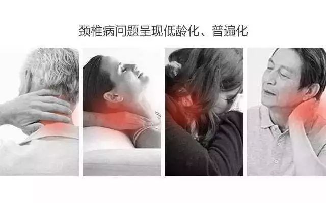 頸椎病問題呈現(xiàn)低齡化/普遍化